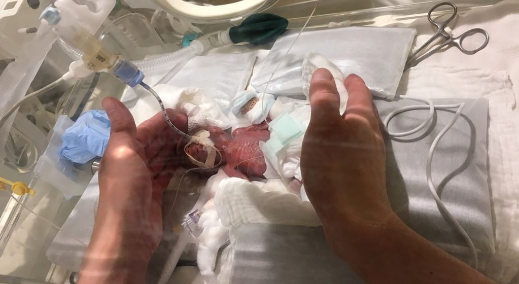 مشفى ياباني يسمح بنقل أصغر رضيع في العالم إلى منزله