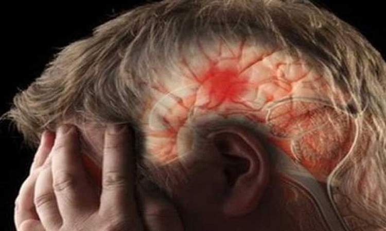 بينها الصداع.. أعراض شائعة تنذر بالسكتة الدماغية لا تتجاهلها