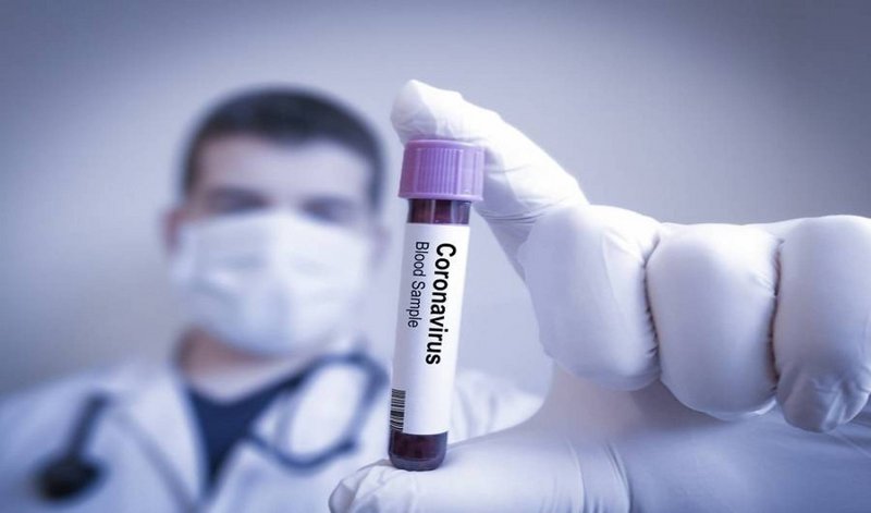 شركة أميركية تتحدث عن علاج محتمل لفيروس كورونا