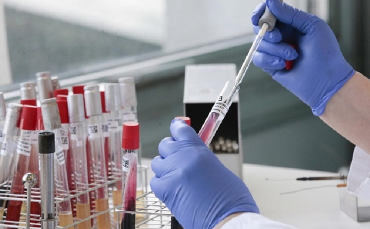 عقار اسرائيلي ينقذ حياة 7 مصابين بكورونا