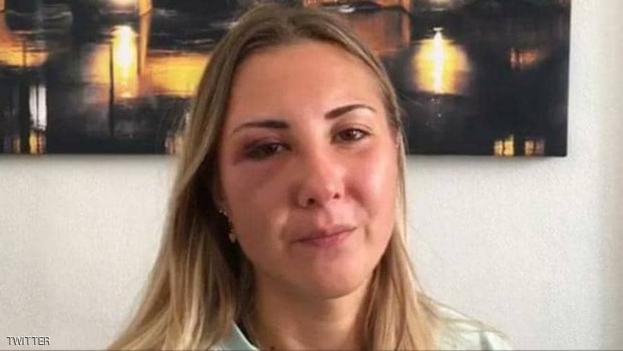 وصفته فرنسا بـ 'الخطير للغاية'.. إعتداء علني مشين على شابة لسبب 'صادم' (صورة)