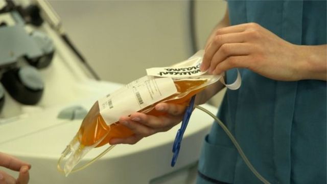 دراسة تظهر نتائج 'صادمة' بشأن فعالية بلازما دم المتعافين من كورونا 