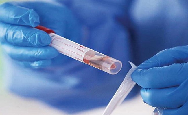 بقيمة 500 مليون جنيه.. بريطانيا تقترب من شراء 60 مليون جرعة من لقاح كورونا