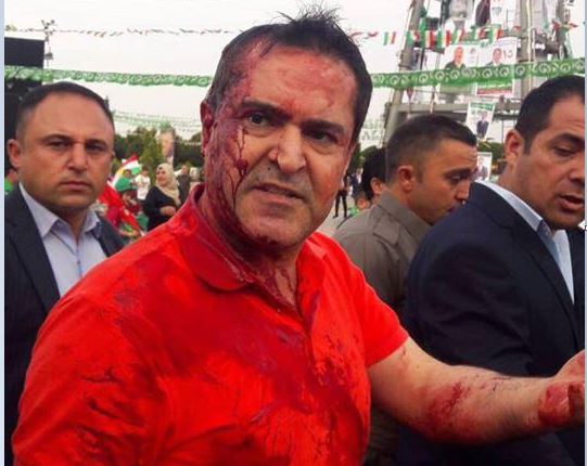 إصابة رئيس قائمة الجيل الجديد في أربيل بجروح إثر الهجوم عليه